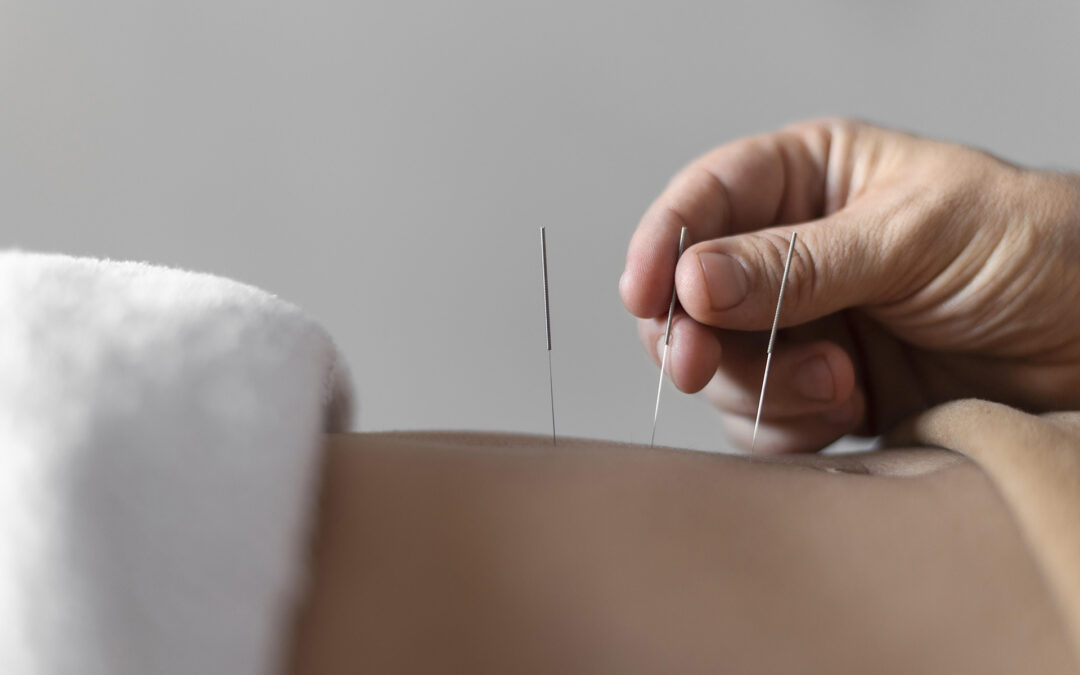 Ai Poliambulatori il Sole arriva l’agopuntura della dottoressa Buratti